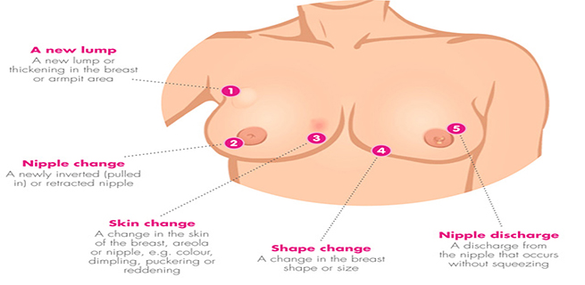 Nipple Changes To be Checked Out - WomenWorking
